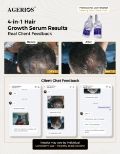 Sérum Capixyl pour la croissance des cheveux avec Redensyl, Anagain et Procapil, anti-chute et réparateur, avec du palmier nain pour hommes et femmes - Product Image 4