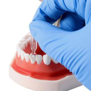 अच्छी कीमत दंत मिश्रित राल दांत तेजी से सफेदी उपकरण दंत शिएर्स मोल्ड किट लाइट इलाज - Product Image 3