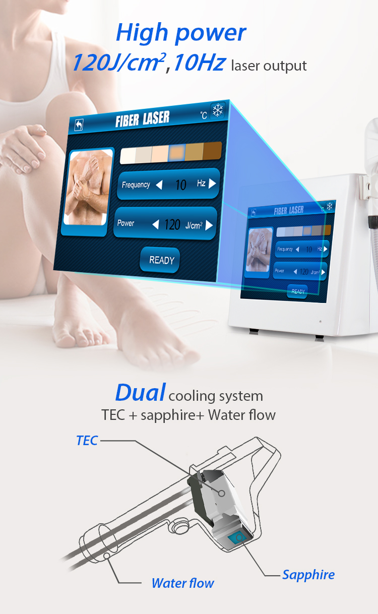 Astiland Fiber Laser Hair Removal Machine Permanent 50000000 Shots Lifespan
