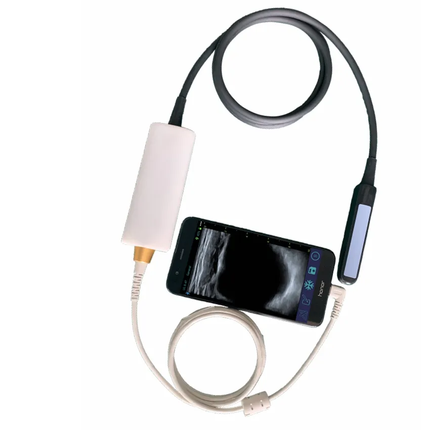 휴대용 퍼스널 컴퓨터와 패드를 위한 USB 직장 조사 B 초음파 스캐너