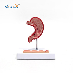 Modèle d'ulcère gastrique, modèle de perforation gastrique, modèle pédagogique de pathologie de l'estomac humain, modèle de coupe transversale gastrique - Product Image 1