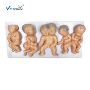 Malformation Fetuses Model montessori biological model teaching aids