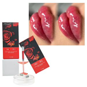 Remplisseur HA monophasé avancé réticulé enrichi en VB12 pour le repulpage des lèvres et l'anti-âge - Product Image 3