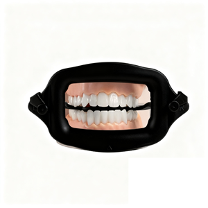 Pulizia dentale monouso ortodontico grande Comfort nero blu rosa Zoom denti sbiancamento linguetta in Silicone guancia riavvolgitore - Product Image 5