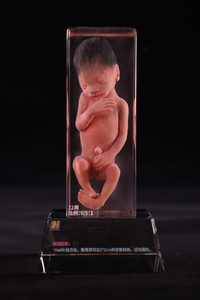Modèle d'embryon imprimé en 3D d'embryons malformés Apprentissage de l'<span class=keywords><strong>embryologie</strong></span> pour l'éducation médicale - Product Image 2