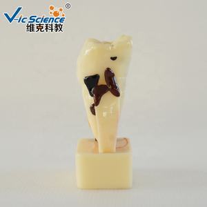 Modelo de Dentes Humanos em Quatro Vezes para Doenças Periodontais, Modelo Educacional em Ciências Médicas - Product Image 5