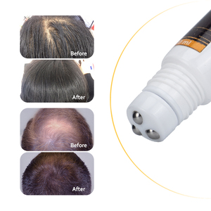 Aceite <span class=keywords><strong>para</strong></span> <span class=keywords><strong>el</strong></span> crecimiento del cabello, productos <span class=keywords><strong>para</strong></span> <span class=keywords><strong>el</strong></span> crecimiento del cabello <span class=keywords><strong>para</strong></span> mujeres negras, suero <span class=keywords><strong>para</strong></span> <span class=keywords><strong>el</strong></span> crecimiento del cabello con rodillo - Product Image 2