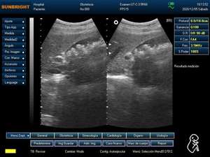 JM-800D <strong>Cheapest</strong> Selling Advanced Portable Black &amp; White <strong>Ultrasound</strong> Machine 3D <strong>Ultrasound</strong> Scanner for Human - Product Image 5