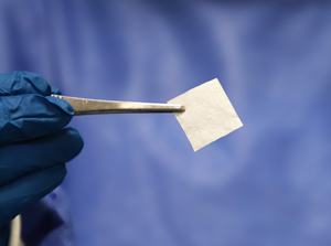 Membrana orale del collagene impianto dentale Sterile del dente dello strato del collagene dentale - Product Image 5