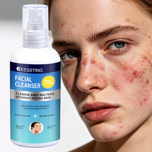 Nettoyant Quotidien Visage OEM/ODM Contrôle Sébum Exfoliant Peaux Mortes Resserre les Pores Élimine les Imperfections et les Éruptions Cutanées - Product Image 1