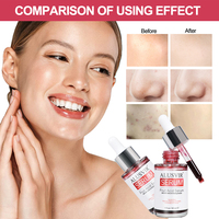 Private Label Huidverzorging Fruit Zuur Gezicht Serum Whitening Anti Rimpels Anti Acne Aha Bha Gezicht Serum Producten Voor Gezicht