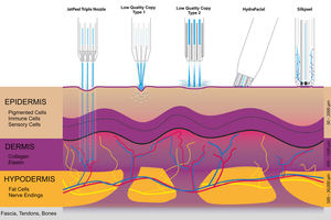 Appareil de soin du visage Oxygen Jet 5 en 1 <span class=keywords><strong>Oxyjet</strong></span> Jetpeel Jet Peel Water Peel - Product Image 4