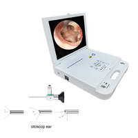 Endoscope chirurgical 17 pouces pour ORL (oreille, nez, gorge) avec caméra 1080p pour usage vétérinaire