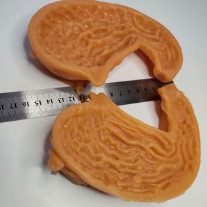 KyrenMed 3D modèle d'anastomose gastrique humaine modèle d'entraînement de l'estomac bivalve silicone grandeur nature pour la pratique de la chirurgie générale - Product Image 2