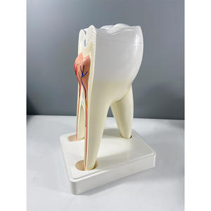 Modelo de Anatomía Humana Ampliado para Enseñanza de Biología y Ciencias Médicas, Modelo de Dientes Molares de 2 Partes con Decadencia Dental - Product Image 2