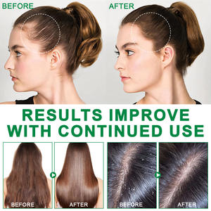 ALIVER 안티 에이징 그린 아라비카 커피 콩 추출 오일 도매 정제되지 않은 순수 천연 커피 에센셜 오일 - Product Image 4