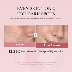 Tónico Facial medicube PD RN Pink Peptide I Pink Glow para Revitalizar, Calmar y Suavizar la Piel, Tono Desigual de la Piel - Product Image 5