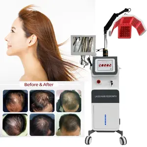 650nm kırmızı Led ışık terapisi makine anti-epilasyon derisi saç çıkma analizi Pdt makinesi