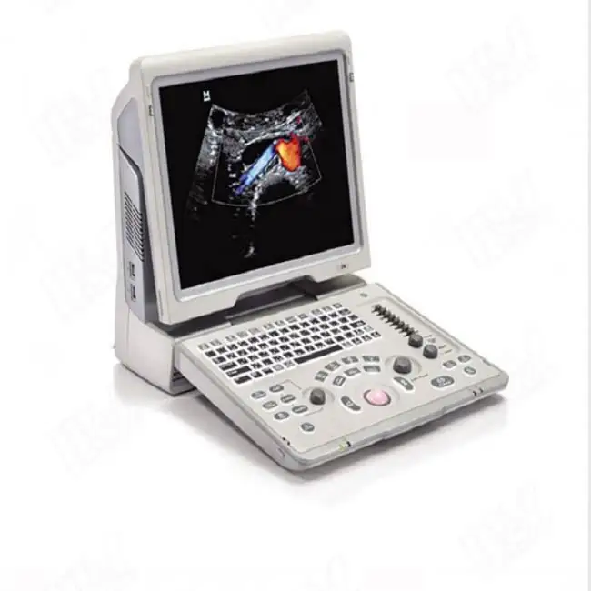 Mandray Z6 Mesin Ultrasound Doppler Warna 4d Portabel dengan Probe Ultrasound Mindray