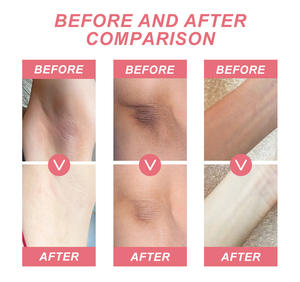 Crema blanqueadora de axilas y puntos oscuros OEM para piernas, rodillas, nudillos, cuerpo, áreas sensibles, axila, crema para el cuidado de la piel - Product Image 6