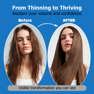 OEM ซื้อแบบขายส่ง วิตามินกัมมี่บำรุงเส้นผม ช่วยเสริมสร้างโครงสร้างคอลลาเจน กระตุ้นการผลิตเคราติน บำรุงรากผมและหนังศีรษะ - Product Image 5