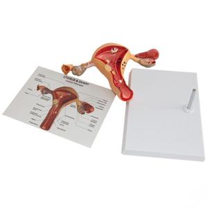 Model pengajaran medis Model anatomi ologis & petrokimia manusia untuk pendidikan ginekologi - Product Image 2