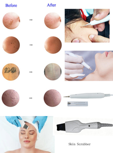 <span class=keywords><strong>AURO</strong></span> - Lo Último en Máquinas Faciales Multifuncionales 10 en 1 con Alta Frecuencia, Aspiradora, Exfoliante de Piel, Martillo Frío y Caliente para Salón - Product Image 5