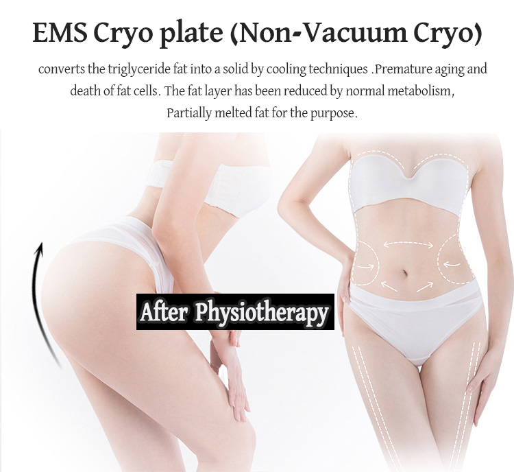 Portable Cryotherapy cooling ems pads, 4 cryolipolysis ems plate freezing slimming machine LF-272