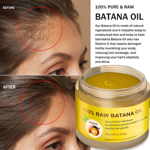 Aceite de Batana SunpinHerb Vegano, Herbal, Nutritivo, Hidratante, para el Crecimiento y Reparación del Cabello, Puro, Orgánico, Natural, para Todo Tipo de Cabello - Product Image 3