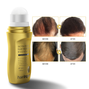 <strong>Biotin</strong> <strong>Hair</strong> Growth <strong>Oil</strong> Fast <strong>Hair</strong> Regrowth Serum Organic <strong>Hair</strong> Growth <strong>Oil</strong> - Product Image 1