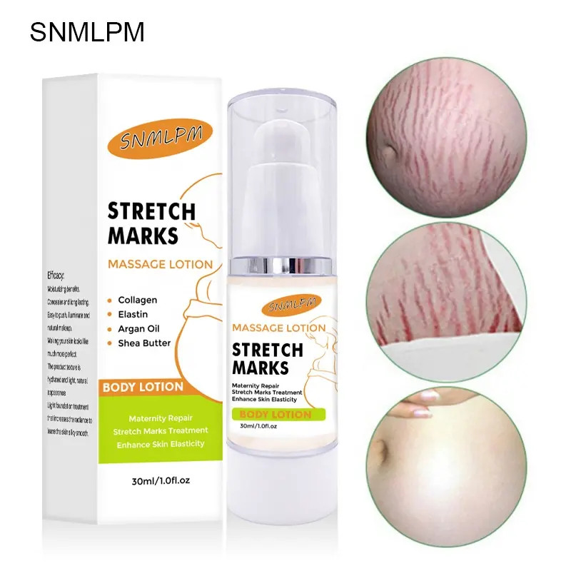 Factory Direct Supplier Safe Organic Ingredient Skin Rescue Pregnancy Scars Remover Repair Strech Marks Removal Cream