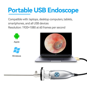 Endoscopio Veterinario USB 1080P con Cámara de Endoscopia de Luz Fría, Aumento de 6x y Función de Congelación de Imagen para Inspección Animal - Product Image 3