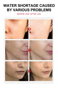 OEM marchio Private Label cura della pelle Niacinamide siero Anti invecchiamento viso <span class=keywords><strong>L</strong></span> acido ascorbico idratante acido ialuronico siero viso - Product Image 5