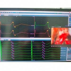 16 canais monitoramento intraoperatório sistema IONM médico profissional sistema neuromonitoring intraoperatório - Product Image 4