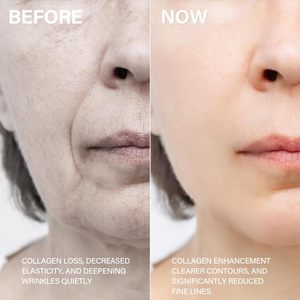 Set Coreano per la Cura della Pelle con Peptidi PDRN, Acido Ialuronico, Essenza di DNA di Salmone, Ampolla Dorata per Pelle Luminosa e Riparazione con Peptidi - Product Image 6