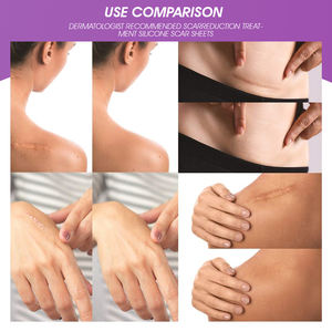 Patch en silicone ELAIMEI pour cicatrices, soin avancé, cicatrisation rapide, réparation de la peau, hydratant, bande de couverture en silicone - Product Image 3
