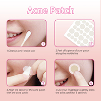 Patchs Hydrocolloïdes Personnalisés pour l'Acné et les Boutons, Autocollants Imperméables pour les Imperfections, Certifiés CE, Fabricant OEM ODM
