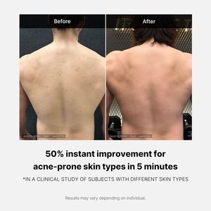 Nettoyant corporel Medicube Red 14,10 oz à faible pH, hydratant, avec acide salicylique, acide lactique, niacinamide, acide hyaluronique - Product Image 5