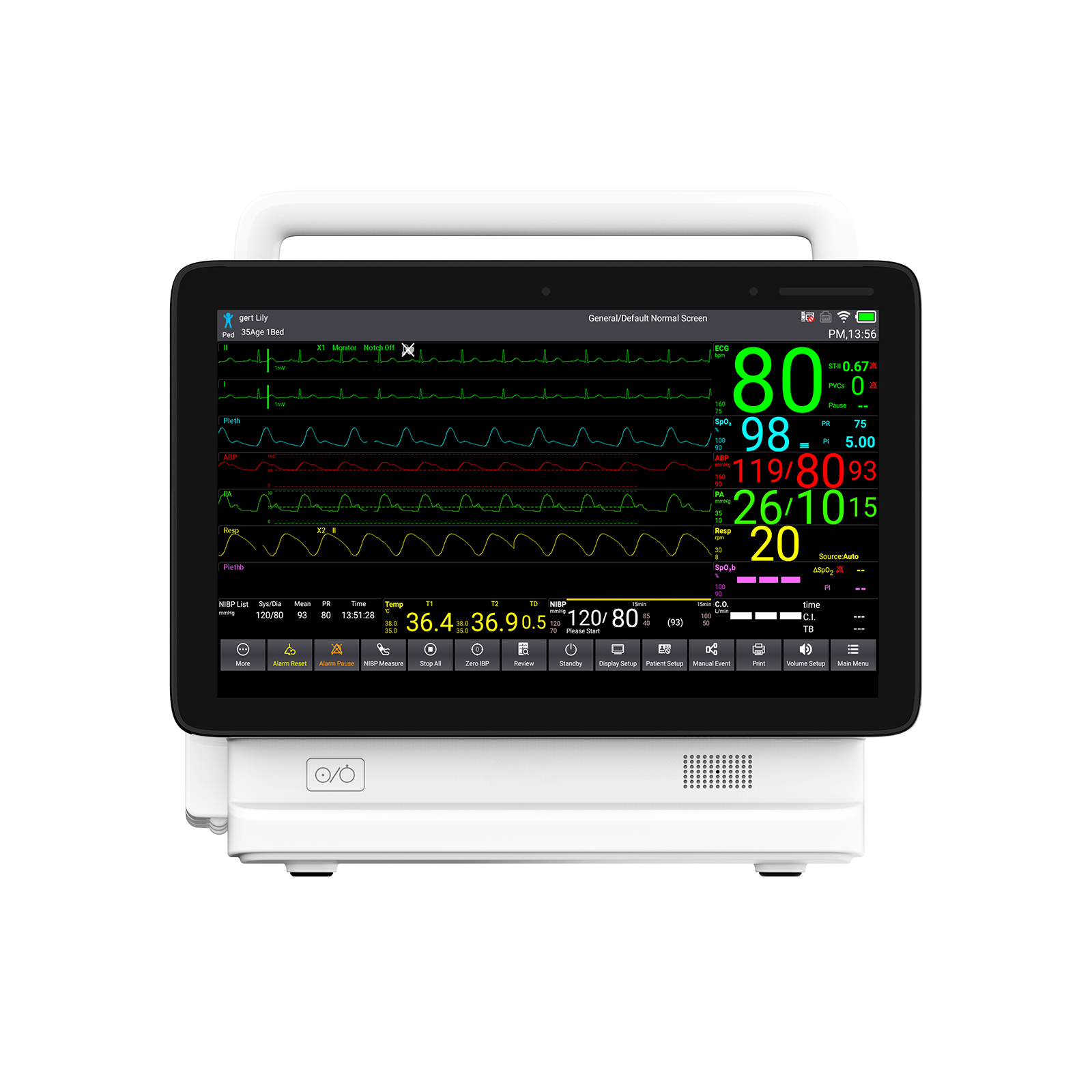 contec ts13插入式患者监护仪icu生命体征监护仪capnograph ibp监护仪