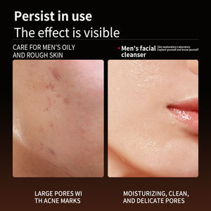 <span class=keywords><strong>Nettoyant</strong></span> <span class=keywords><strong>Visage</strong></span> <span class=keywords><strong>Homme</strong></span> Sel Marin Anti-Acné Purifiant <span class=keywords><strong>Nettoyant</strong></span> <span class=keywords><strong>Visage</strong></span> <span class=keywords><strong>Nettoyant</strong></span> Hydratant Nourrissant Peau Non Serré <span class=keywords><strong>Lait</strong></span> <span class=keywords><strong>Nettoyant</strong></span> Hommes - Product Image 5