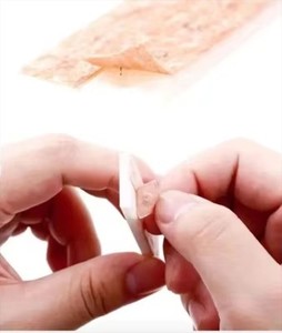 Sterile Pressnadeln - Product Image 5