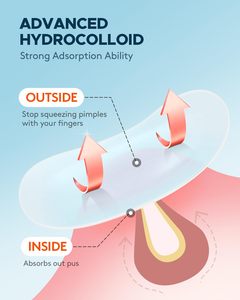 Anthrive - لاصقة علاج حب الشباب النباتية, هيدروكولود مع زيت شجرة الشاي, لاصقة حب الشباب لتغطية الثديين والعيوب - Product Image 5