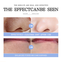 Film de boue solide Schtroumpf personnalisé OEM pour réparer l'acné et rétrécir les pores masque facial bâton pour nettoyer et appliquer le bâton de film de boue