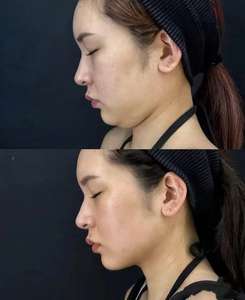 เซรั่มบำรุงผิวสูตรไลโปไลติกเพื่อการฟื้นฟูผิวอย่างมีประสิทธิภาพ - Product Image 3