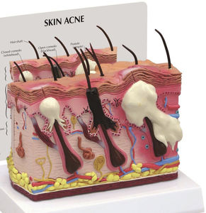 Modello anatomico della pelle umana per la biologia oggetto di metallo modello di occhio per <span class=keywords><strong>le</strong></span> scuole per gli ospedali modello di insegnamento di scienza medica Acne - Product Image 2