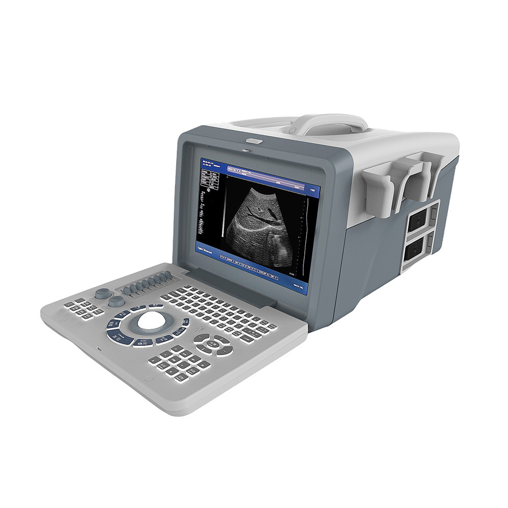 LTUB61 Tabletop medical full digital 10.4 inch LED human pregnancy ultrasound machine portable