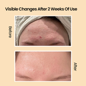 Cosméticos Coreanos para el Cuidado de la Piel, Colágeno, Reparación de Caracoles, Suero Facial Antienvejecimiento, Esencia Facial, Marca Privada, Líquido Natural para Mujeres, 500 - Product Image 3
