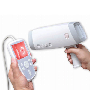 Draagbare Digitale Videovagina Colposcoop Voor Gynaecologisch Onderzoek Optisch Medisch Instrument - Product Image 3