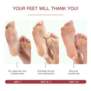 Crème de protection des pieds Han Linger Private Label pour talons fendillés, exfoliante et <span class=keywords><strong>anti</strong></span>-fissures, réparation des peaux mortes - Product Image 3