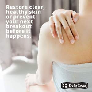 ครีมซัลเฟอร์ครีม Seye 2.6ออนซ์รักษา<span class=keywords><strong>สิว</strong></span>ด้วย<span class=keywords><strong>ฮอร์โมน</strong></span>ปลอดภัยและมีประสิทธิภาพครีมบำรุงจุดด่างดำทุกวัน10นาที - Product Image 3